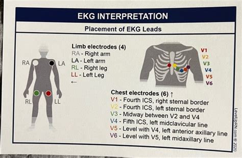 EKG Interpretation Flashcards Quizlet