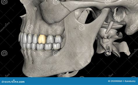 The First Maxillary Molar Is The Only Tooth Of The Maxillary Molars