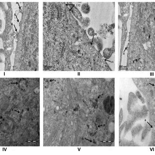 Tem Micrograph Of Hydrophilic Spion Coated With Different Ligands A