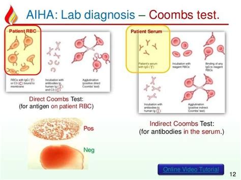 Direct Vs Indirect Coombs Test Masonropbyrd