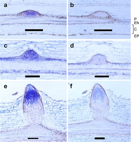 Detection Of 91071 Mrna In Primordia Of Lateral Roots Of Noncolumnar