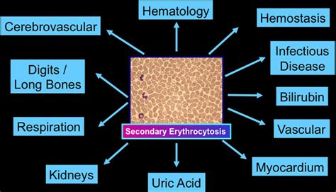 Management Of Adults With Cyanotic Congenital Heart Disease Heart