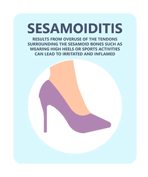 Sesamoiditis: What Is It, Symptoms, Causes & Podiatry Treatment