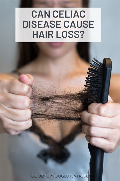 Can Celiac Disease Cause Hair Loss Good For You Gluten Free