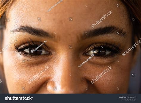 People With Black Eyes