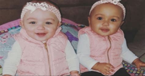 Mother Gives Birth To Twins Discovers Something About Them That Is