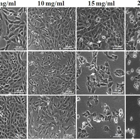 Apoptotic Gene Expression In Mcf7 Cells A Qrt Pcr Analysis Of Mcf7