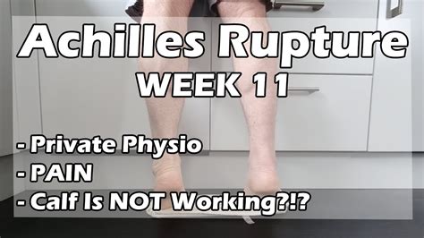 Achilles Rupture Recovery Week Non Surgical Youtube