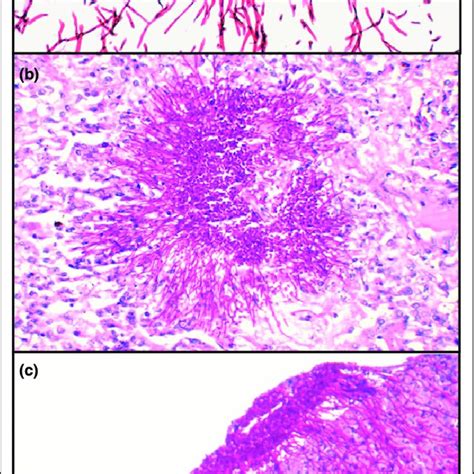 PDF Importance Of The Candida Albicans Cell Wall During Commensalism