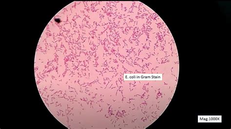 Atlas Of Bacteria Introduction And List Of Bacteria And Related Features