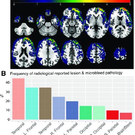 Lesion Distribution Map And Radiological Reporting A Lesion Overlap