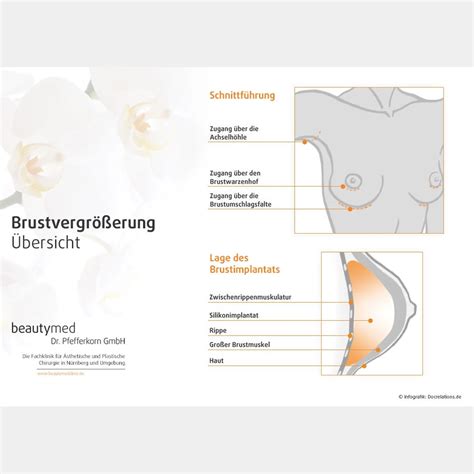 Infografik Brustvergr Erung Praxismarketing Pr Docrelations Gmbh