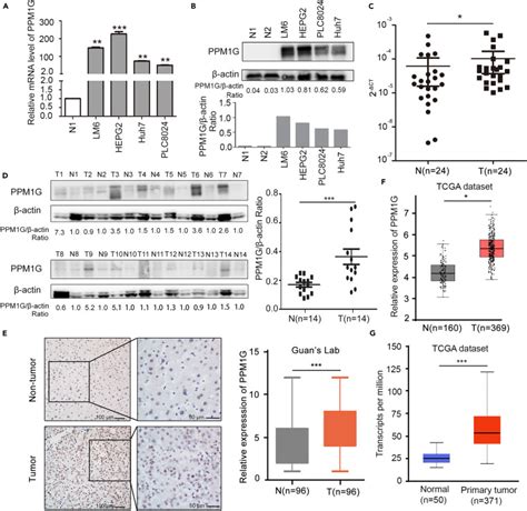 Ppm1g Promotes Cell Proliferation Via Modulating Mutant Gof P53 Protein