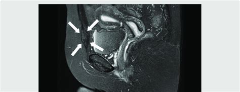 Magnetic Resonance Imaging Of The Pelvis Sagittal Section White Download Scientific Diagram