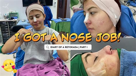 Rhinoplasty Journey Part Surgery Day At The Raynald Center