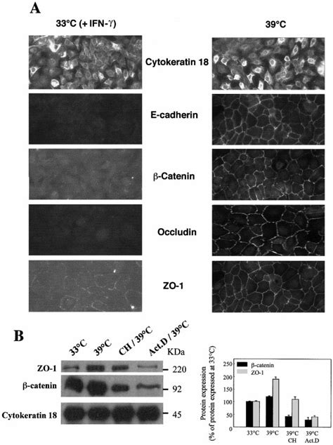 A Expression Of Cytokeratin 18 E Cadherin Catenin Occludin And