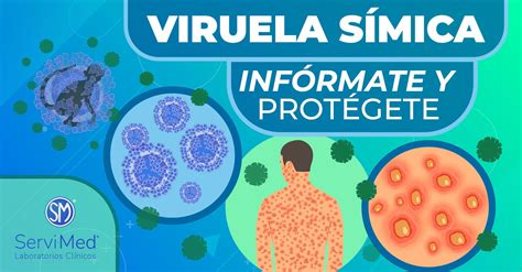 Viruela S Mica Servi Med Laboratorios Cl Nicos