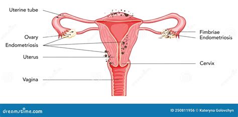 Diagrama De Tero Del Sistema Reproductivo Femenino Con Inscripciones