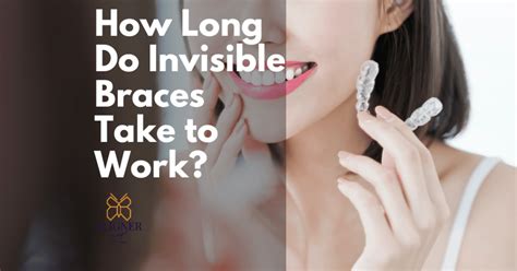 How Long Do Invisible Braces Take To Work [explained]