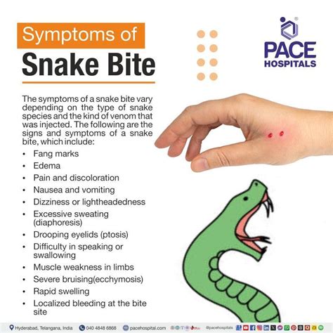 snake bite types symptoms  diagnosis treatment