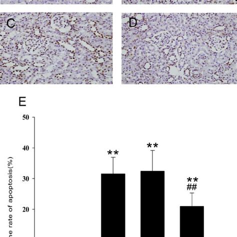 Imd Suppressed Cell Apoptosis Triggered By Renal Iri A D