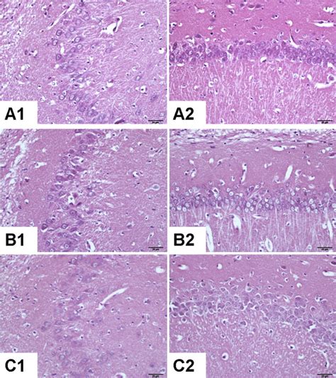 Ca3 And Ca1 Of Hippocampus X 40 Magnification A1 A2 Normal Control