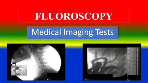 Fluoroscopy Medical Imaging Tests What Is Uses Need