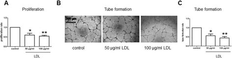 Ldl Attenuates Cell Proliferation And Tube Formation Of Hcmec D3 Cells Download Scientific