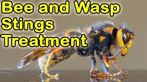 How To Treat Bee And Wasp Stings Bee And Wasp Stings Wasp Stings