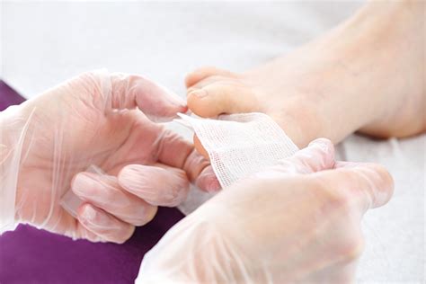 Ingrown Toenail Treatment | HK Podiatry | Maroubra & Padstow Podiatrists