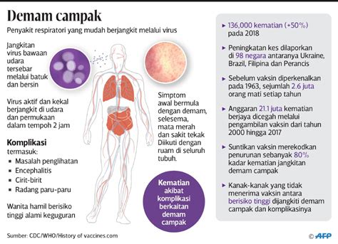 Gerakan Antivaksin Punca Kes Ruam Campak Meningkat Di Negara Ini