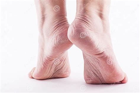 Dry Heels Woman On A White Background Closeup Stock Photo Image Of