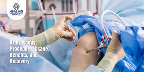 Arthroscopy Procedure Usage Benefits And Recovery