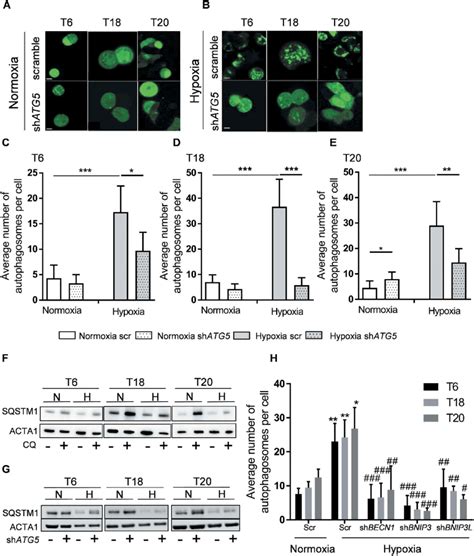 Hypoxia Induces The Formation Of Autophagosomes And Autophagy Download Scientific Diagram