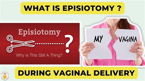 What Is An Episiotomy Stitches During Vaginal Delivery Why Episiotomy Stitches Youtube