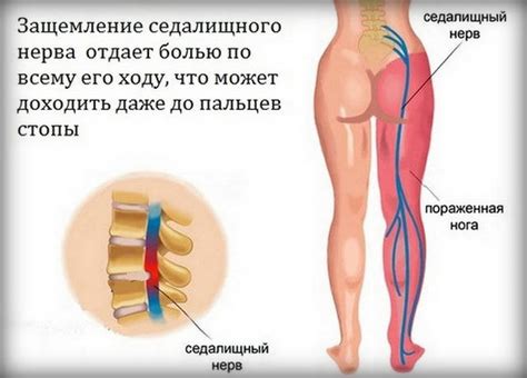 Bolovi u leđima metastaze uzroci simptomi i savjeti za brzo olakšanje