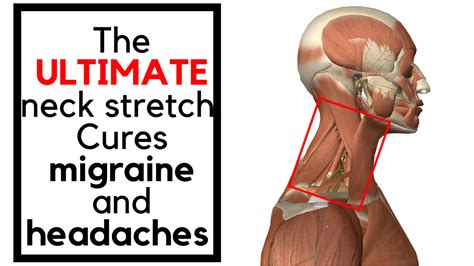 Ideal Balance Acupuncture Levator Scapula Neck Pain Hot Sex Picture