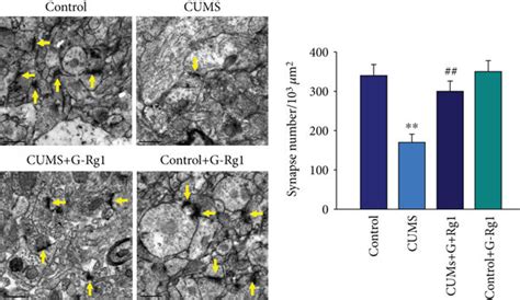 Ginsenoside Rg Decreases Neural Apoptosis In Hippocampal Ca Regions