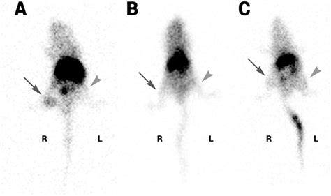 Scintigraphic Acquisition Of Athymic Nude Mice Bearing CD R And