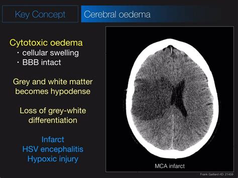 Twitter | Radiology imaging, Medical radiography, Radiology