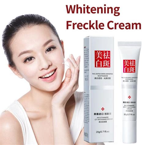 Whitening Freckle Cream Freckle Removal Cream Whitening Anti Melasma