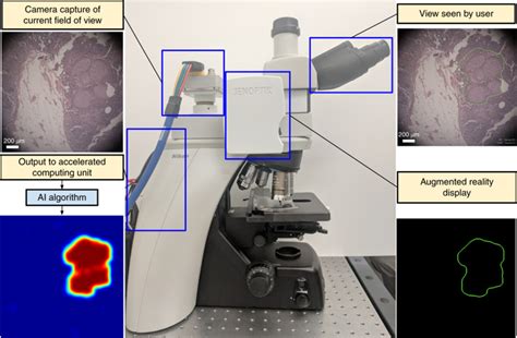 An Augmented Reality Microscope With Real Time Artificial Intelligence