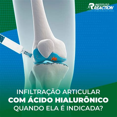 Infiltração articular ácido hialurônico Quando ela é indicada