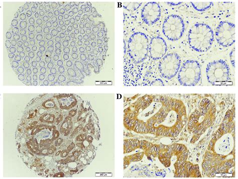 Immunohistochemical Staining Of Representative Tissue Microarray Cores Download Scientific