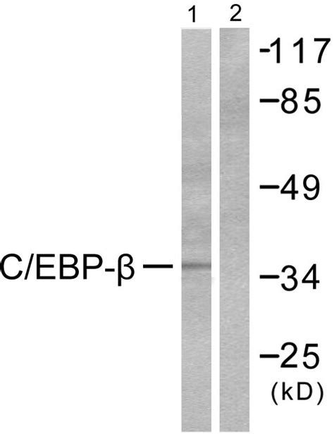 Anti Cebp Beta Cebpb Antibody Rabbit Anti Human Polyclonal Lsbio