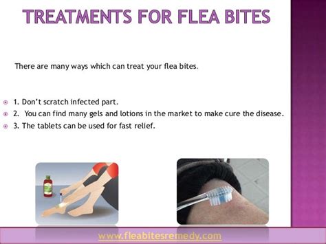 Flea Bites Remedy