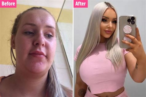 I Spent £60k On Plastic Surgery Ive Had Boob Jobs Lipo Filler