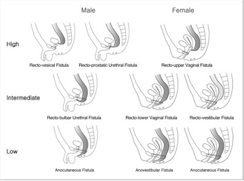 Female Anus