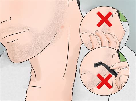 17 Ways to Stop Itching After Shaving - wikiHow