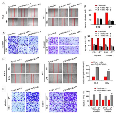 Long Non Coding RNA RHPN1 AS1 Promotes Tumorigenesis And Metastasis Of